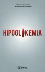 Hipoglikemia - Waldemar Karnafel