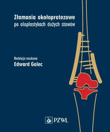Złamania okołoprotezowe po aloplastykach dużych... - Edward Golec