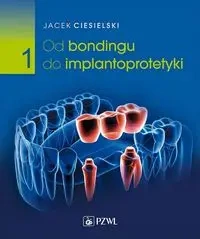 Od bondingu do implantoprotetyki cz. I - Jacek Ciesielski