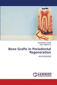 Bone Grafts in Periodontal Regeneration - MOHAMMAD AAMIR