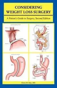 Considering Weight Loss Surgery - Ihde Glenn M.