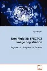 Non-Rigid 3D SPECT/CT Image Registration - Eskofier Björn