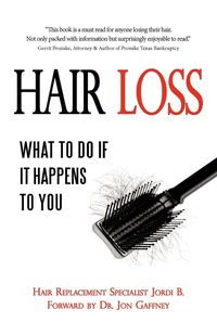 Hair Loss - Jordi B.