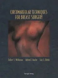 Circumareolar Techniques for Breast Surgery - Wilkinson Tolbert S.