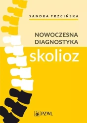 Nowoczesna diagnostyka skolioz - Sandra Trzcińska