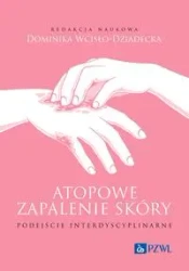 Atopowe zapalenie skóry. Podejście interdyscyplina - Dominika Wcisło-Dziadecka
