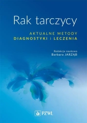 Rak tarczycy. Aktualne metody diagnostyki i leczen - Barbara Jarząb