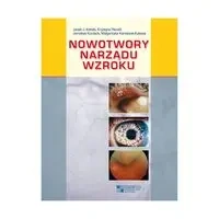Nowotwory narządu wzroku - praca zbiorowa