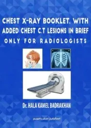 Chest X-Ray Booklet, with added Chest C.T Lesions in brief Only for Radiologists - BADRAKHAN Dr. HALA KAMEL