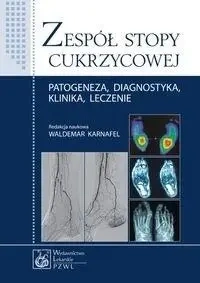 Zespół stopy cukrzycowej - praca zbiorowa