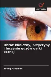 Obraz kliniczny, przyczyny i leczenie guzów gałki ocznej - Young Azuamah