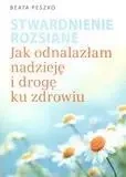 Stwardnienie rozsiane - Beata Peszko