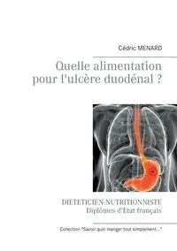 Quelle alimentation pour l'ulcère duodénal ? - Menard Cédric