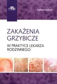 Zakażenia grzybicze w praktyce lekarza rodzinnego - Joanna Narbutt