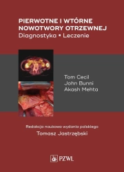 Pierwotne i wtórne nowotwory otrzewnej. Diagnostyk - Tom Cecil, John Bunni, Akash Mehta