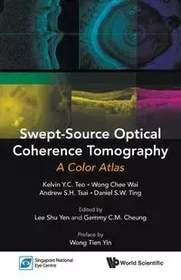 SWEPT-SOURCE OPTICAL COHERENCE TOMOGRAPHY - KELVIN WAI ANDREW Y C TEO CHEE WONG S