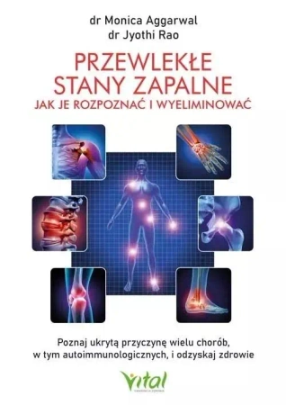 Przewlekłe stany zapalne jak je rozpoznać - dr Jyothi Rao, dr Monica Aggarwal