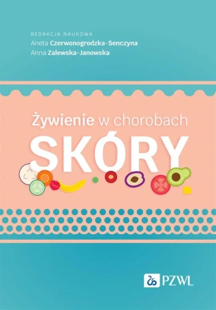 Żywienie w chorobach skóry - Aneta Czerwonogrodzka-Senczyna, Anna Zalewska-Jan