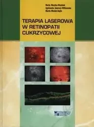 Terapia laserowa w retinopatii cukrzycowej - Maria Muzyka-Woźniak, Agnieszka Jamrozy-Witkowska, Marta Misiuk-Hojło