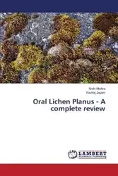 Oral Lichen Planus - A complete review - Mishra Nishi