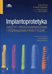 Implantoprotetyka Zalety przeciwwskazania rozwiązania praktyczne - Bruna Ezio, Andrea Fabianelli, Pavolucci Giulio