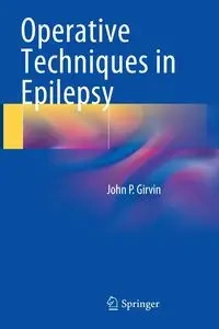Operative Techniques in Epilepsy - John P. Girvin