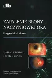 Zapalenie błony naczyniowej oka - Sandhu H.S., Kaplan H.J.