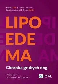 Lipoedema. Choroba grubych nóg. Podejście interdyscyplinarne - Karolina Chęś, Monika Domagała, Artur Mieczkowski, Dorota Stettler