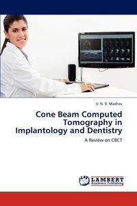 Cone Beam Computed Tomography in Implantology and Dentistry - Madhav V. N. V.