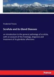 Scrofula and its Gland Diseases - Frederick Treves