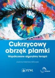 Cukrzycowy obrzęk plamki. Współczesne algorytmy... - Joanna Adamiec-Mroczek