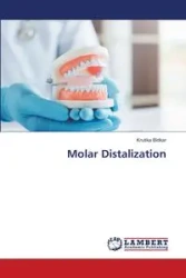 Molar Distalization - Bidkar Krutika