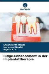 Ridge-Enhancement in der Implantattherapie - Hegde Shashikanth