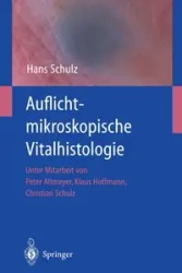 Auflichtmikroskopische Vitalhistologie - Hans Schulz