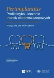 Periimplantitis. Profilaktyka i leczenie tkanek... - Elżbieta Dembowska, Renata Górska