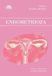 Endometrioza - Chopra S.