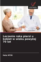 Leczenie raka piersi u kobiet w wieku powyżej 70 lat - MTIR Hela