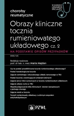Obrazy kliniczne tocznia rumieniowatego układ cz.2 - Maria Majdan