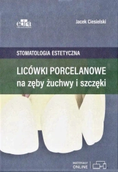 Licówki porcelanowe na zęby żuchwy i szczęki - Jacek Ciesielski
