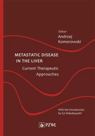 Metastatic Disease in the Liver - Andrzej Komorowski