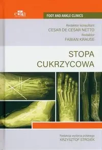 Stopa cukrzycowa - Strojek Krzysztof