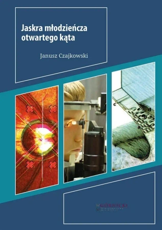 Jaskra młodzieńcza otwartego kąta - Janusz Czajkowski