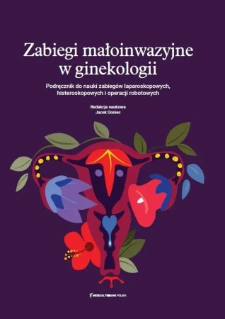 Zabiegi małoinwazyjne w ginekologii - dr Jacek n. med. Doniec