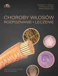 Choroby włosów. Rozpoznanie i leczenie - Alexander C. Katoulis, Rigopoulos Dimitris