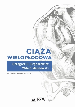 Ciąża wielopłodowa - Grzegorz H Bręborowicz, Witold Malinowski