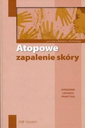 Atopowe zapalenie skóry. Poradnik lekarza praktyka - praca zbiorowa