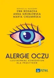 Alergie oczu. Ilustrowane kompendium dla praktyków - Ewa Bogacka, Anna Groblewska, Marta Chełmińska