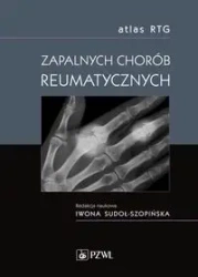 Atlas RTG zapalnych chorób reumatycznych - Sudoł-Szopińska Iwona