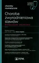 Choroba zwyrodnieniowa stawów. W gabinecie lekarza - Maria Majdan