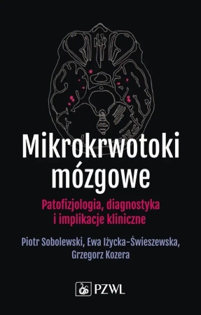 Mikrokrwotoki mózgoww - Piotr Sobolewski, Ewa Iżycka-Świeszewska, Grzegor